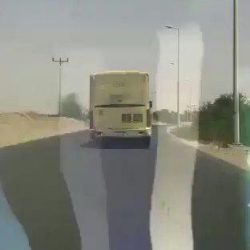 في عمليه نادره جدا حول العالم مفصل صناعي خاص لطفله بالماني عسير