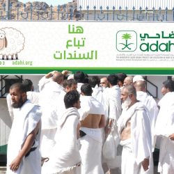 “سعود الطبية” تجدد تحذيراتها من لدغات حيوانات الصيف