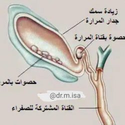 العمري عضو هيئة التدريس بجامعة الملك سعود يتعرض لحادث سير