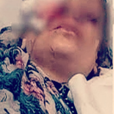 زوج يقتلع عين زوجته