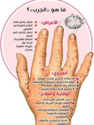 الجرب يغزو إسطنبول والأطباء يعترفون: فشلنا في العلاج