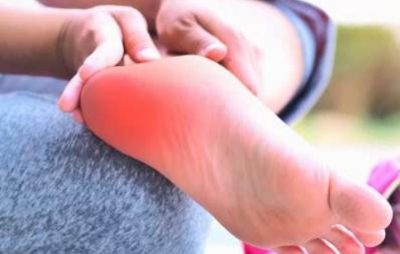الشوكة العظمية: أهم الأسباب وطرق العلاج (ألم الكعب)