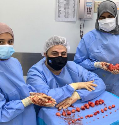فريق طبي في مستشفى الملك عبدالعزيز بالأحساء يخلص مريضة من 34 ليف في رحمها