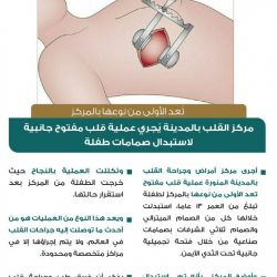 دعم فني لأدوات القياس والتقويم بصبيا ولقاء خاص عن آلية الاختبارات عن بُعد