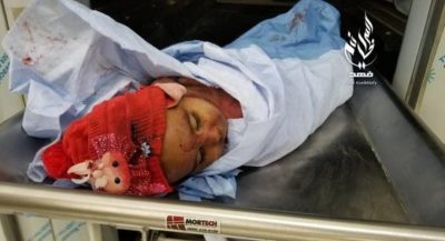 تعز مقتل طفلتين وإصابة 4 بينهم امرأة في قصف حوثي