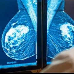 قصة المرأة التي عين الملك عبدالعزيز نفسه وكيلاً شرعياً لها