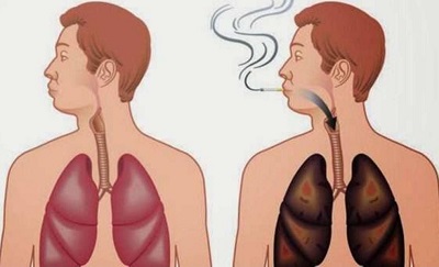 تنظيف الرئتين عند المدخنين بالطرق الطبيعية وبالأعشاب