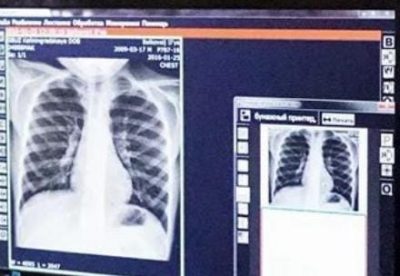10 أطعمة فائقة الجودة لها مفعول السِّحر في الحفاظ على صحة الرئتين