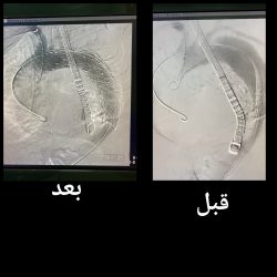 بأكثر من 14 مليون ريال.. “تعليم القنفذة” يفتتح مدارس جديدة في العرضيات