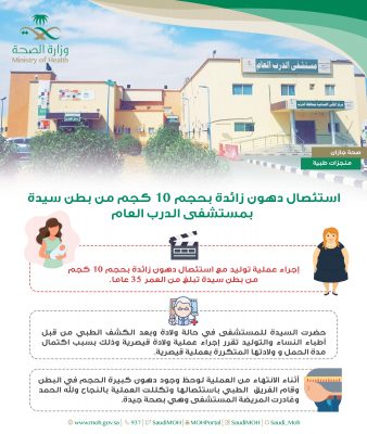 استئصال دهون زائدة بحجم 10 كجم من بطن سيدة بمستشفى الدرب بجازان