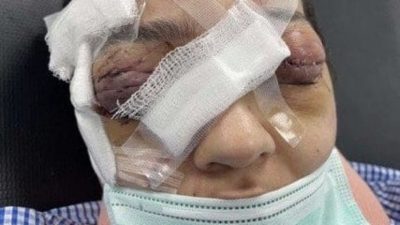 توقيف زوج اعتدى بالضرب بوحشية على زوجته..