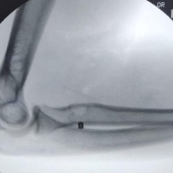 فيصل بن سلمان يفتتح مصفاة الدرة للسكّر.. فيصل بن سلمان يفتتح مصفاة الدرة للسكّر..