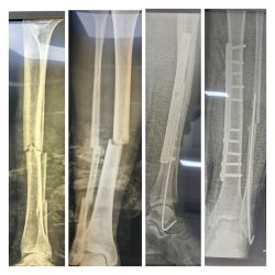 أساليب وأرشادات للتعامل مع التنمر