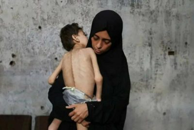 غزة: 11 وفاة جديدة بسبب المجاعة وسوء التغذية وسط تفاقم الأزمة الإنسانية..