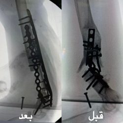 “بر جدة” والمجدوعي للسيارات” يوقعان اتفاقية شراكة مجتمعية لدعم مستفيدي الجمعية..